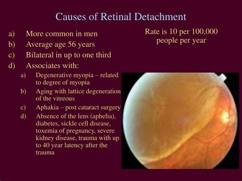 acute vision loss powerpoint    id