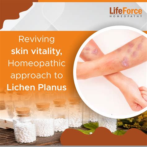 lichen planus treatment reviving skin vitality  homeopathy