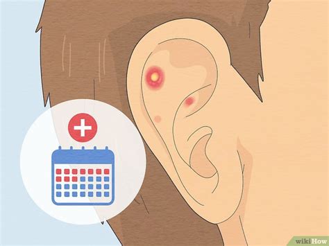How to Get Rid of Pimples inside the Ear: 12 Fast Ways