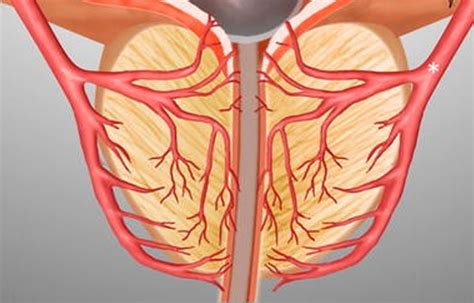 prostatic artery embolization   increased rate