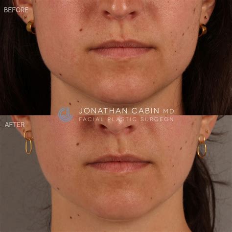 Trying Fringe for Round Face offers a surprising slimming effect 5