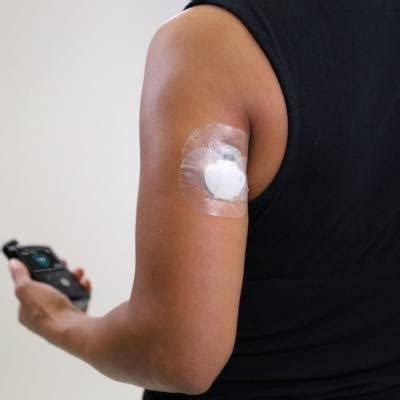 arm placement indication  cgm approved  fda mdedge endocrinology