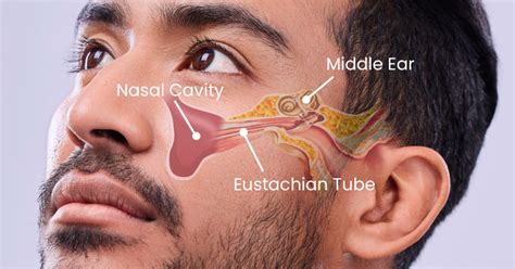 Treating Sinus Infection Ear Pain - Advanced Sinus Relief Centers