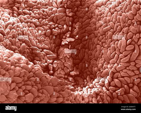 ileum coloured scanning electron micrograph sem   surface