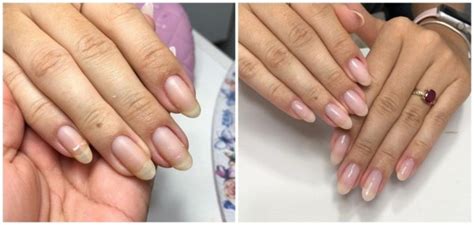 Blindagem De Unhas Prós E Contras - Blindagem de Unha – O que é, Prós e Contras + Como Fazer!