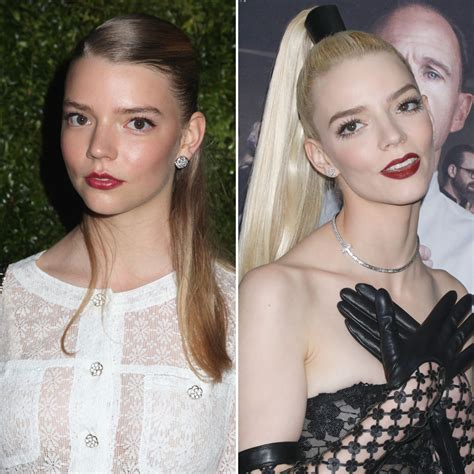 Did Anya Taylor-Joy Get Plastic Surgery? Quotes, Photos | Life & Style