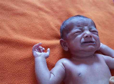 Blue Baby Syndrome: Causes, Signs, and Prevention
