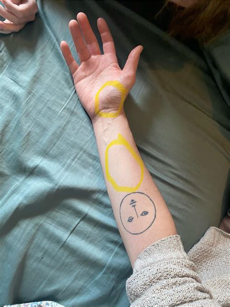 Chronic wrist/forearm pain? : r/climbergirls