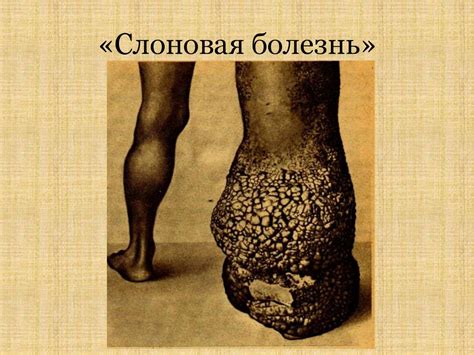 Важнейшие гельминтозы человека. Круглые гельминты. Методы диагностики ...