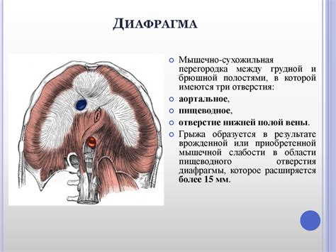 Грыжи пищеводного отверстия диафрагмы - презентация онлайн