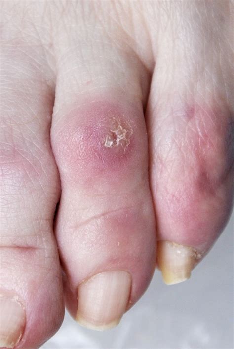 skin pathology refhelp