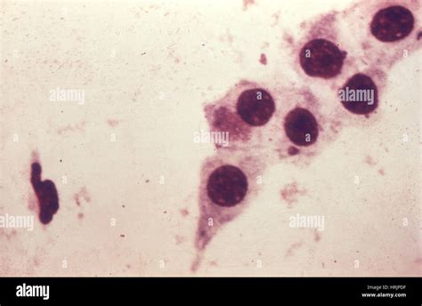 Chlamydia trachomatis Bacteria, LM Stock Photo - Alamy