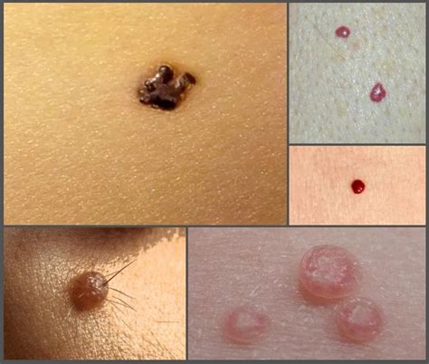 What Are The MOLES? Read Some Fun Facts Related To Moles