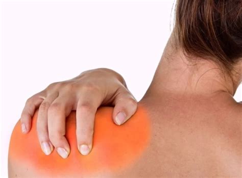 Плечелопаточный периартрит: причины, симптомы ⋆ vertebrology.ru