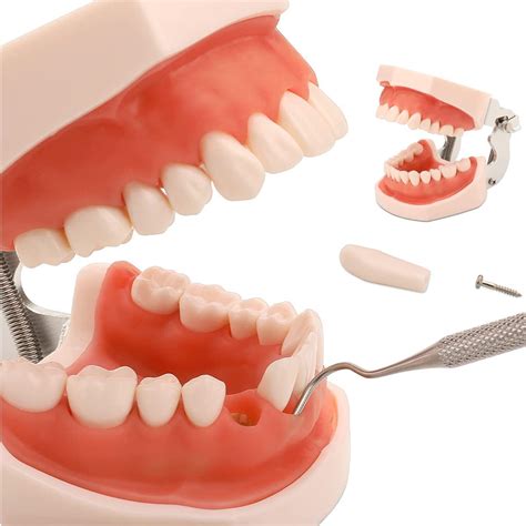 What Dental Materials Are Used To Make Dental Models at Jorja Helms blog
