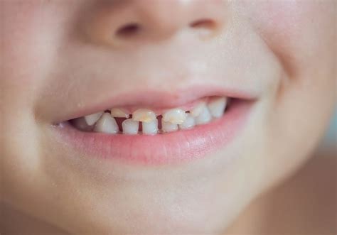 baby teeth fall   sharon melton blog