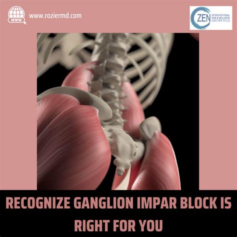 Recognize Ganglion Impar Block Is Right for You In Mansfield, Tx