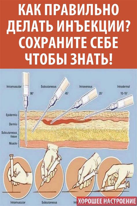 #здоровье #уколы #внутримышечные #подкожные #внутривенные #внутрикожные ...