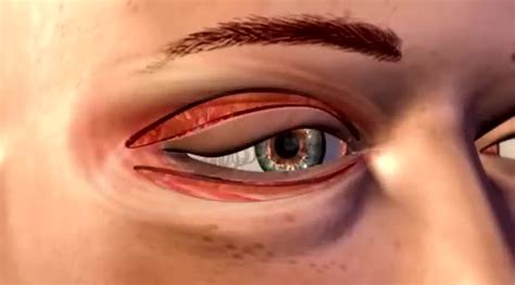 create high quality  medical  surgery animation   animation