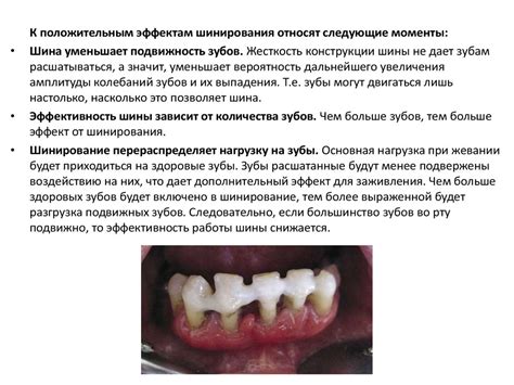 Постоянное шинирование - презентация онлайн