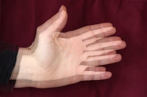 Diplopia - Gejala, Penyebab, dan Pengobatan - Alodokter