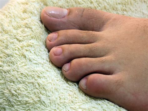 How To Get Healthy Feet And Toenails at Dale Mack blog