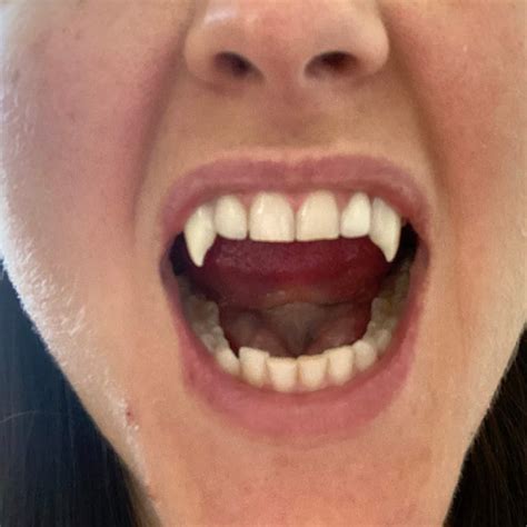 How To Get Vampire Fangs Naturally at Barbara Bryant blog