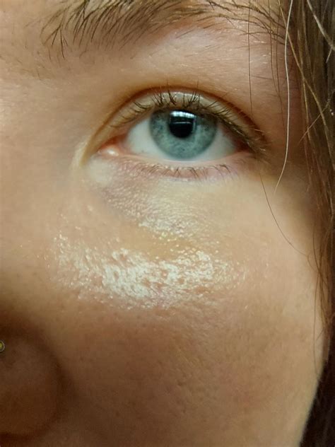 What color is my under eye discoloration? And what color in color ...