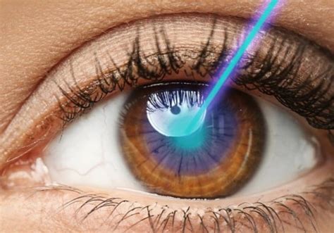 Is Laser Eye Surgery Painful? An Expert's Perspective