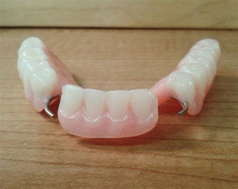 partial denture  lara bunton blog