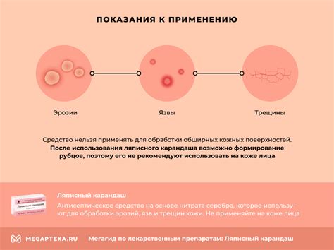 Ляписный карандаш инструкция по применению, цена: Состав и аналоги