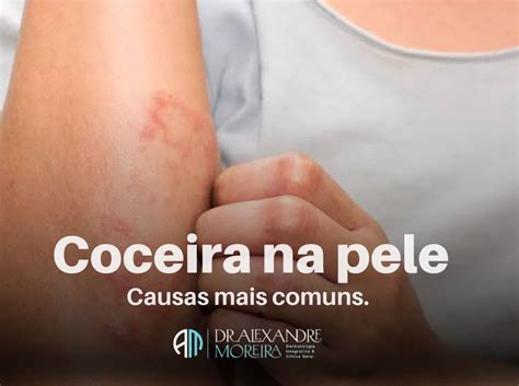 Coceira Na Pepeca O Que Pode Ser