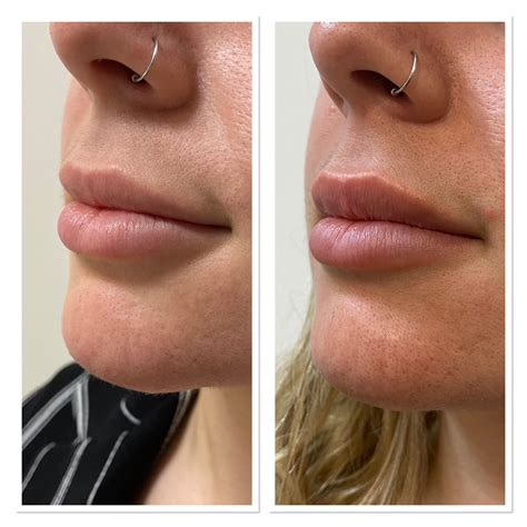InfluencerGoneWild's Honest Before & After: No Filters, No Lies. Image 16