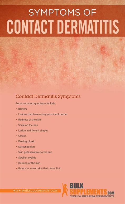 Contact Dermatitis Face Treatment