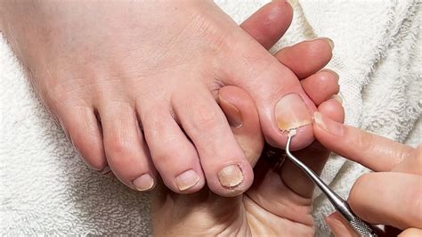 how to clean your toenails