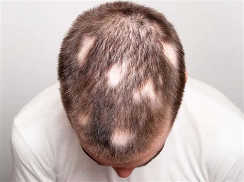 madecassoside dermatologists guide  soothing sensitive skin