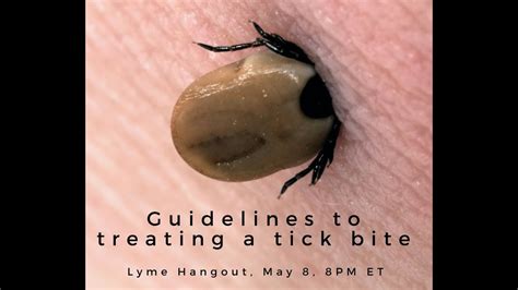 How To Treat Tick Bites - vrogue.co