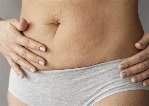 Diástase abdominal: tudo o que deve saber - Trofa Saúde