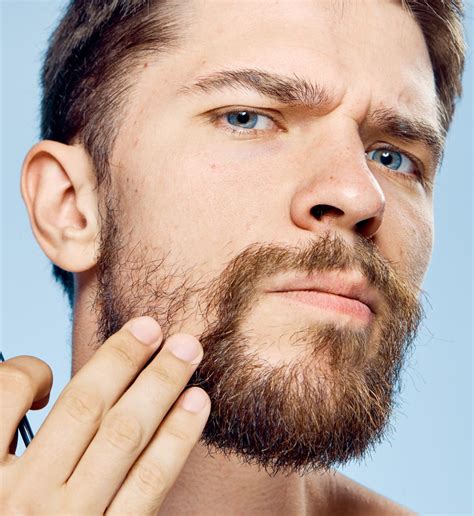 vousy jsou odveky symbol muznosti trapi vas jejich ubytek nepanikarte