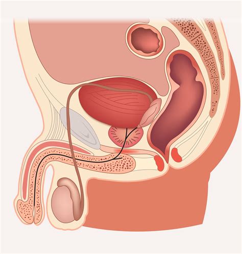 Vasectomy Reversal Diagram Microsurgery Vasectomy Reversal Chesapeake
