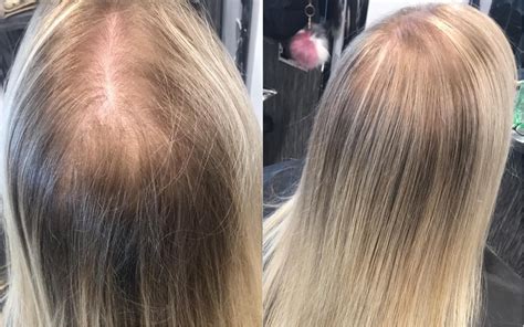 Top Stylists Spill Their BEST-KEPT Secrets For Chic Short Cuts (Fat Faces, Thin Hair?) Image 13