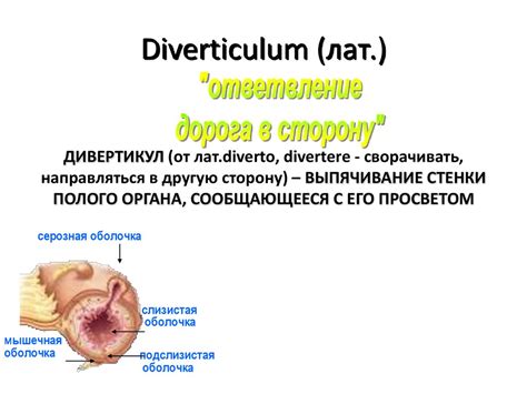 Дивертикулярная болезнь - презентация онлайн