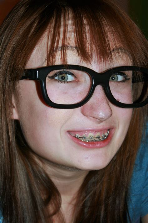 Glasses And Braces Porn