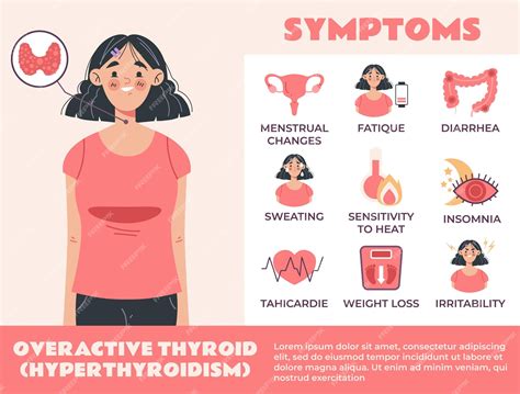 hyperthyroidism face 3