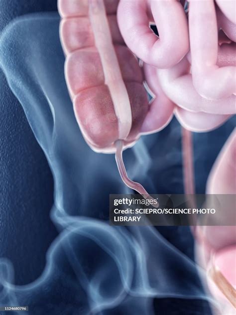 Illustration Of The Human Appendix Anatomy High-Res Vector Graphic ...