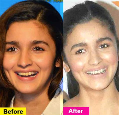 Is Alia Bhatt looking different? - Bollywood News & Gossip, Movie ...