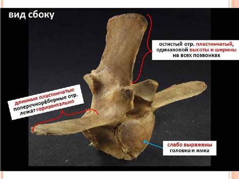 ПОЗВОНКИ vertebrae ПОЗВОНОК КАКОГО ОТДЕЛА ПРЕДСТАВЛЕН ДАЛЕЕ