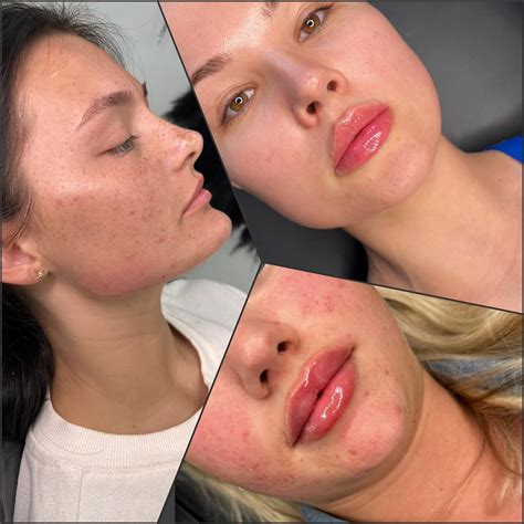 Anais Zanotti - -Train like an Athlete🏋 -Eat like a Nutricionist🍽