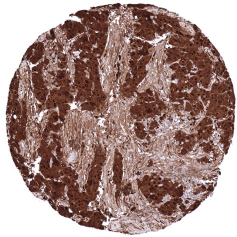 cancer tissue gallery arginase  ms validated antibodies