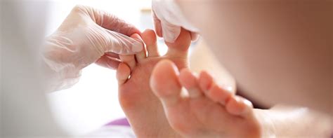 Don't Ignore These Signs! Diabetic Foot Gangrene Early Stages & Treatment